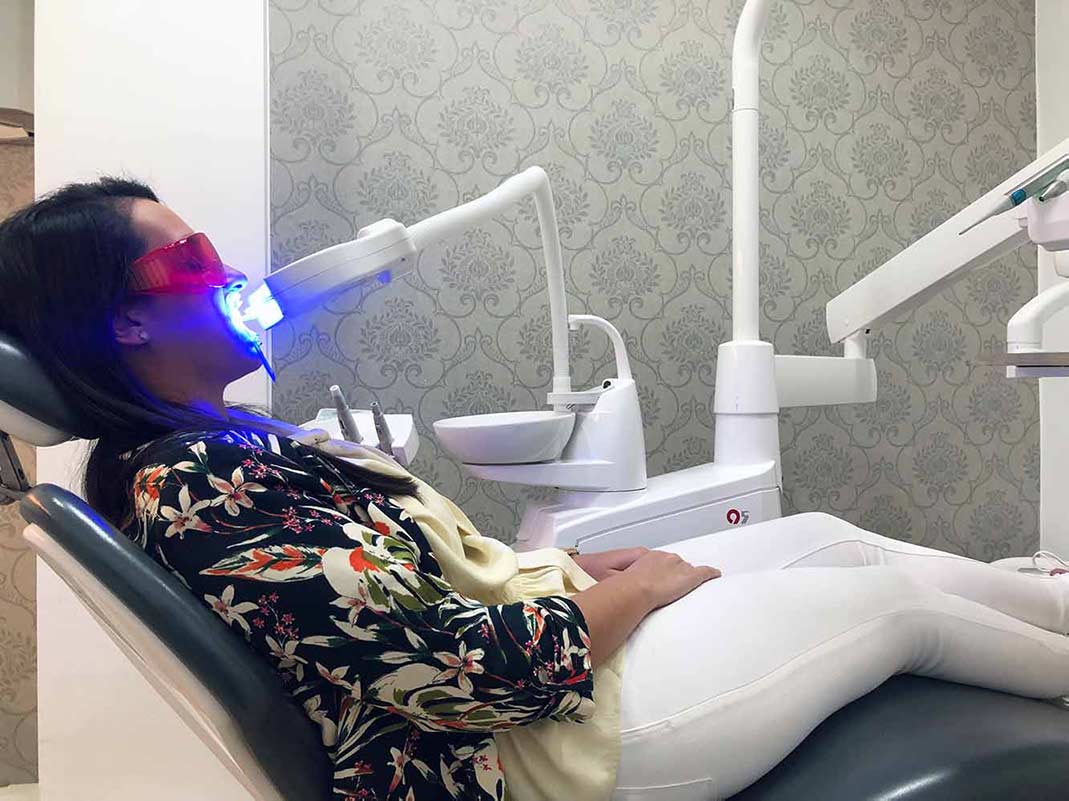 Blanqueamiento dental Clínica Bravo